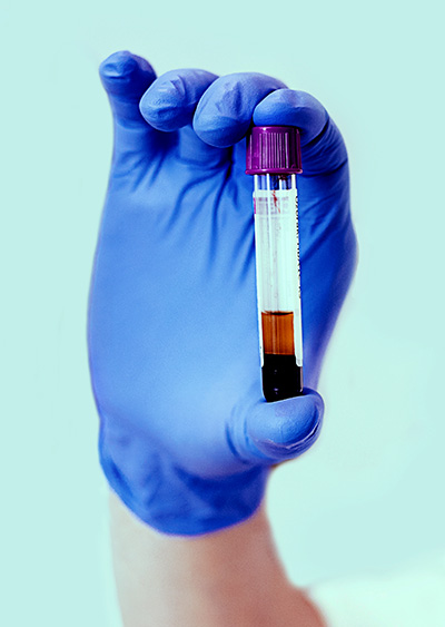 gloved hand holding a vial of blood